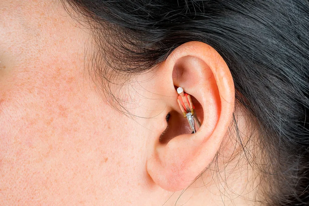 comprendre-les-acouphèneswebp